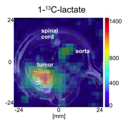 Hyperpolarized 13C pyruvate magnetic resonance spectroscopy for in vivo metabolic phenotyping of rat HCC