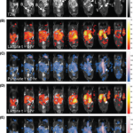 3D bSSFP for hyperpolarized 13C MRI